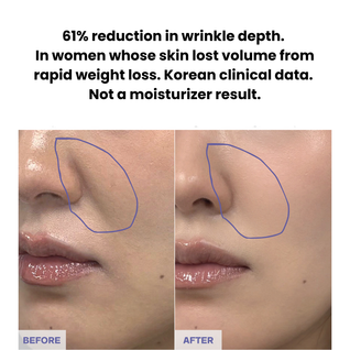 Hyaluronic PDRN ORB Serum