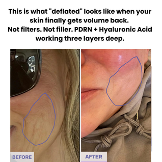 Hyaluronic PDRN ORB Serum